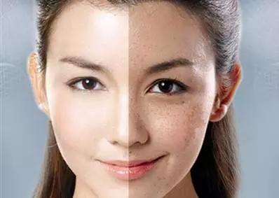 點陣激光是什么？
